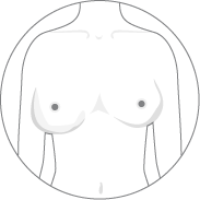 Changes in breast shape or size