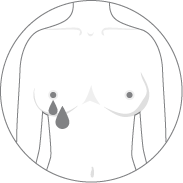 Nipple discharge or changes