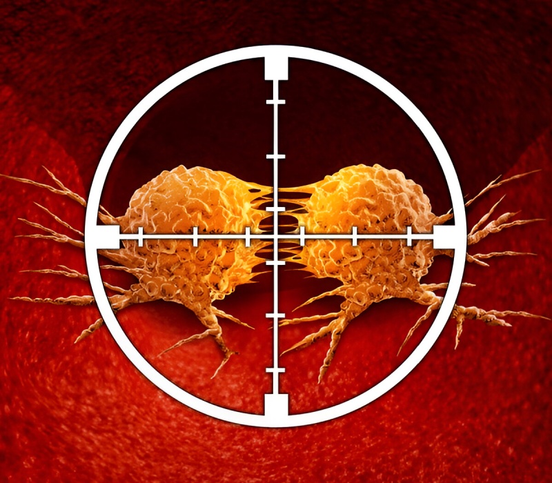 Radionuclide Therapy (Theranostics)