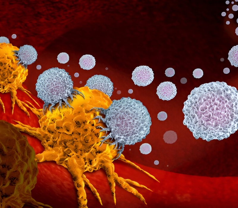 Radionuclide Therapy