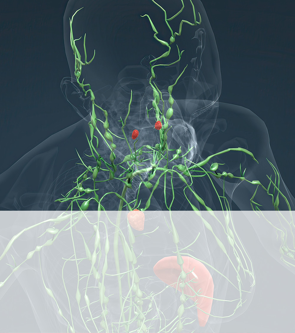 https://thangamcancercenter.com/file/wp-content/uploads/2023/09/Risk-factors-of-Lymphoma-Cancer.jpg