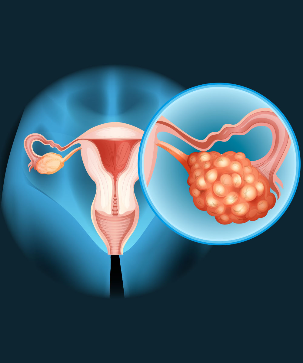 https://thangamcancercenter.com/file/wp-content/uploads/2023/10/Treatment-for-Ovarian-Cancer.jpg