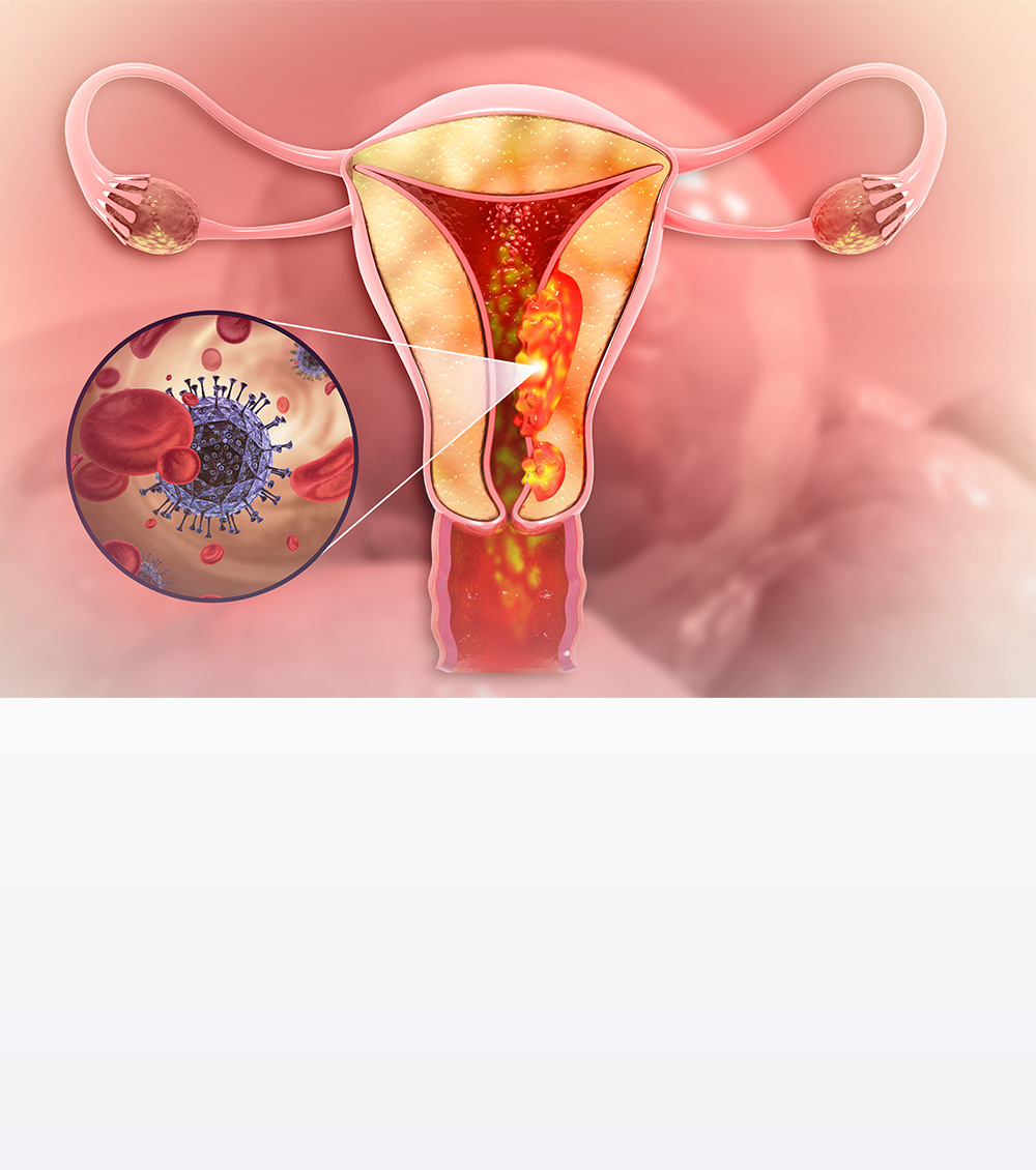 https://thangamcancercenter.com/file/wp-content/uploads/2023/11/Causes-of-Cervix-Cancer.jpg