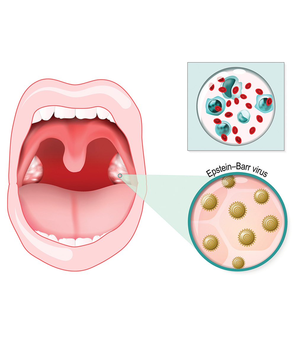 https://thangamcancercenter.com/file/wp-content/uploads/2023/11/What-are-the-treatment-options-available-1.jpg