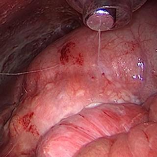 https://thangamcancercenter.com/file/wp-content/uploads/2024/04/Peritoneal-Surface-Oncology-Unitx320.jpg