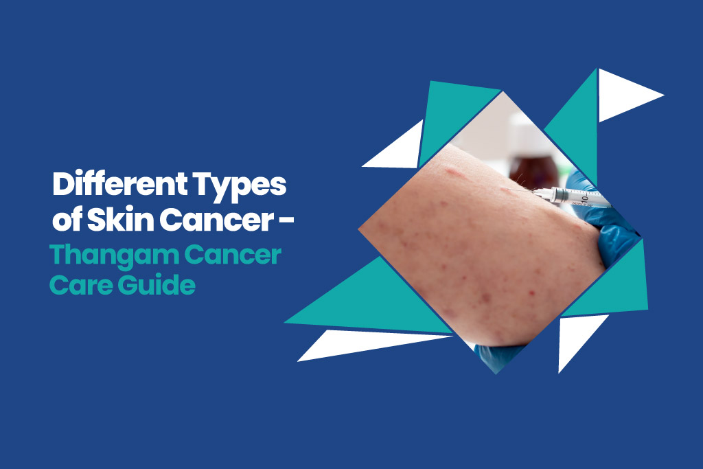 Different types of skin cancer- Thangam Cancer Care Guide