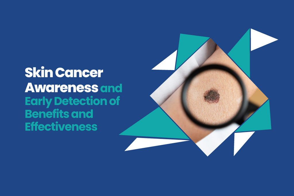 Skin Cancer Awareness and Early Detection of Benefits and Effectiveness