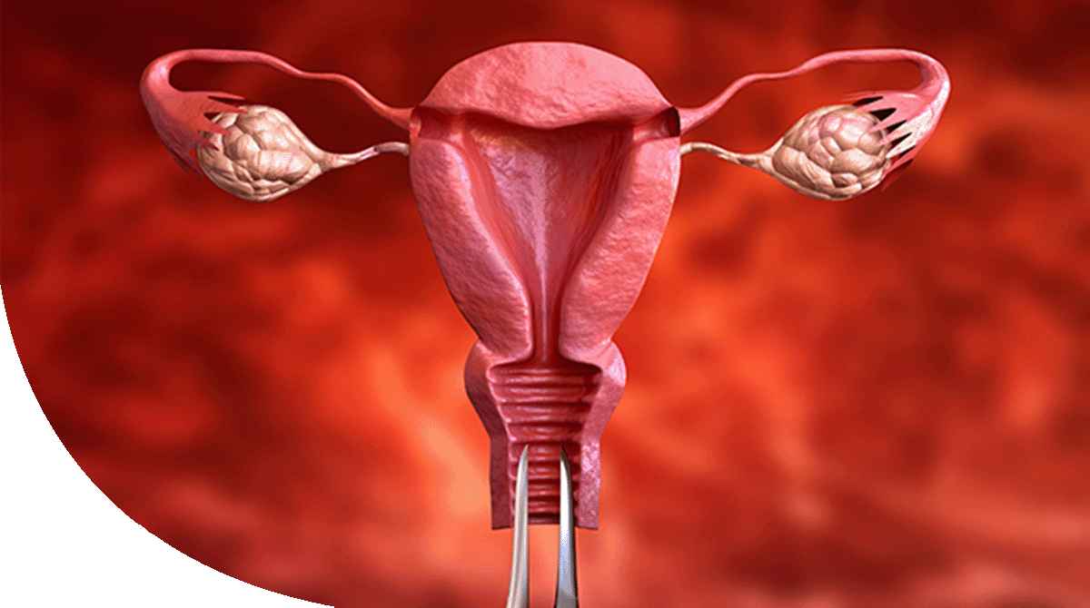 https://thangamcancercenter.com/file/wp-content/uploads/2024/07/Endometrial-Cancer.jpg