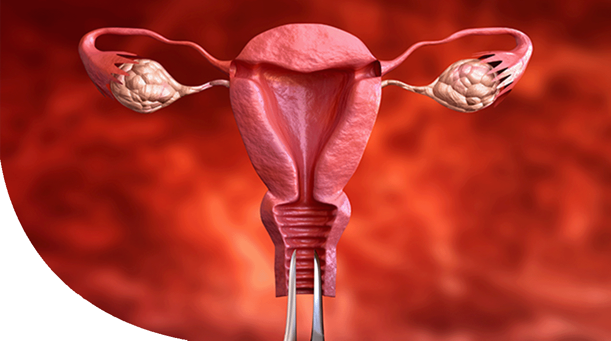 https://thangamcancercenter.com/file/wp-content/uploads/2024/07/Endometrial-Cancer.png