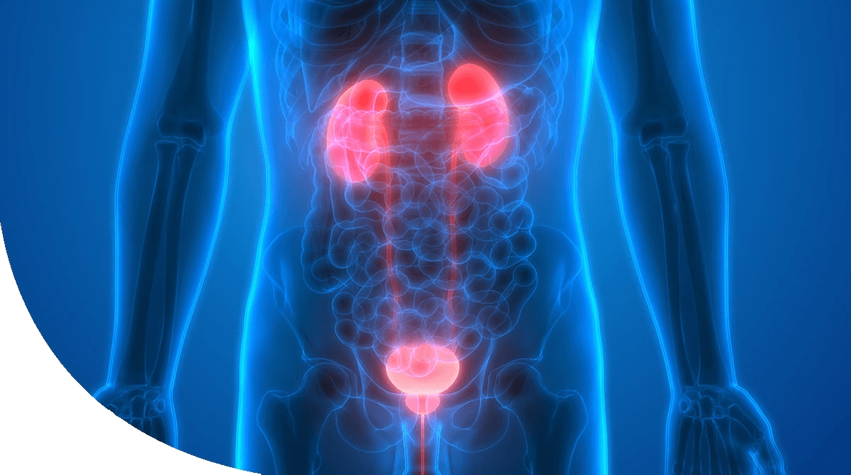 https://thangamcancercenter.com/file/wp-content/uploads/2024/07/Renal-cancer.png