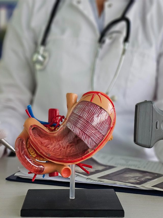 Choosing the right treatment for Stomach Cancer