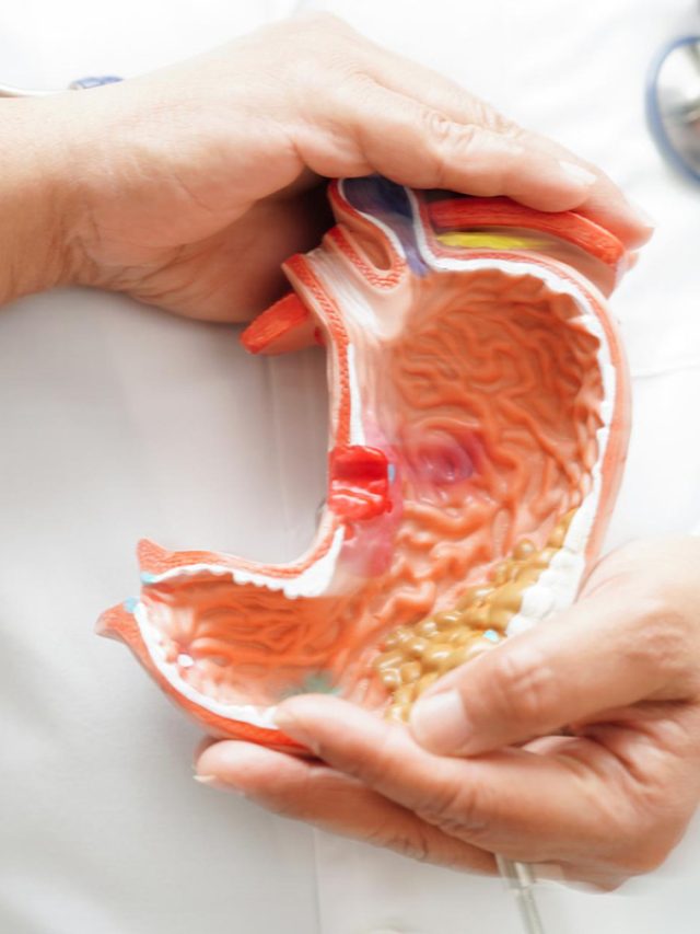 Surgery for Stomach Cancer