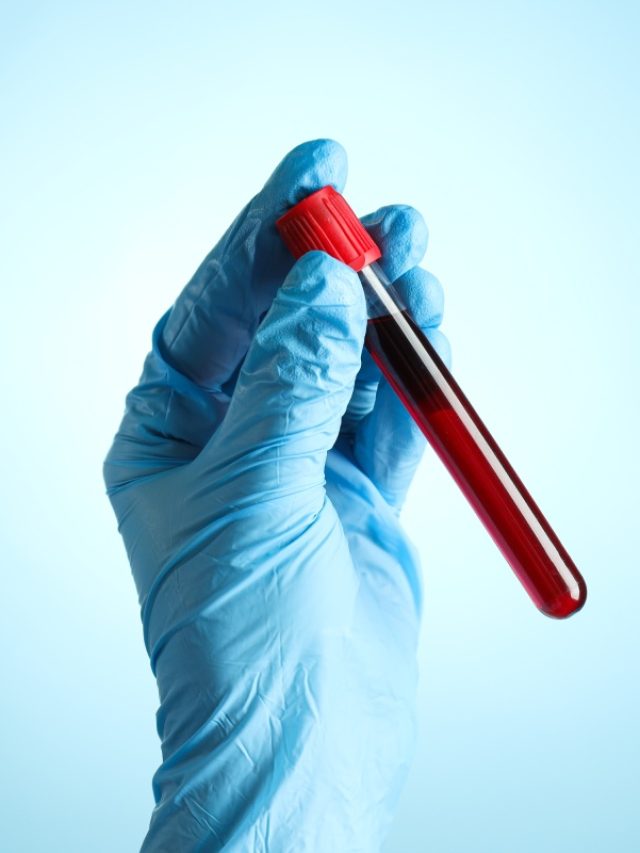 How Blood Cancer Is Diagnosed: Tests you should know