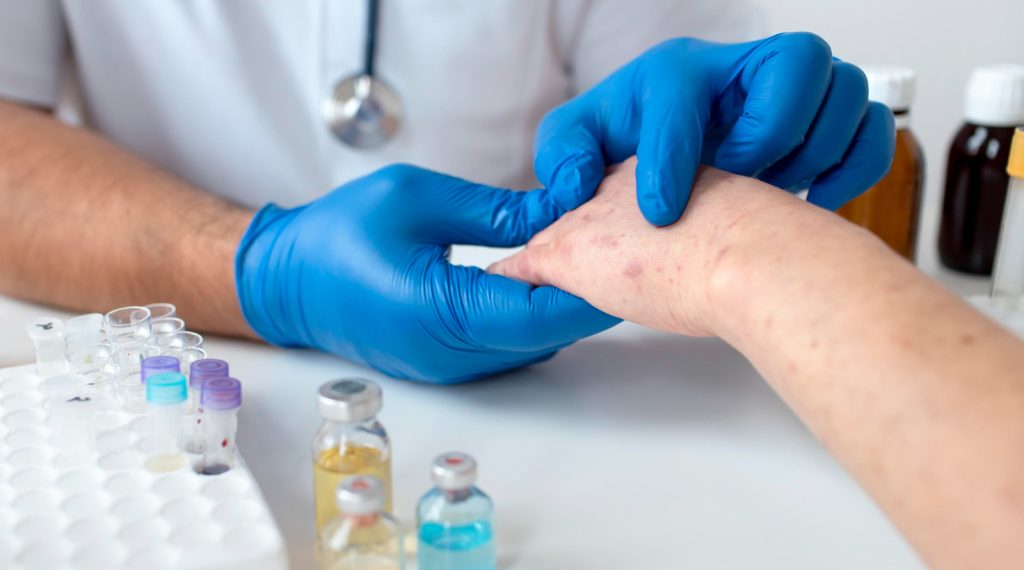 What Is Skin Cancer? Types, Causes and Early Signs
