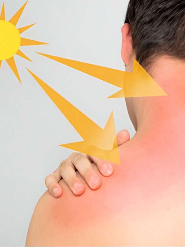 Top Causes of Skin Cancer: Sun Exposure & More